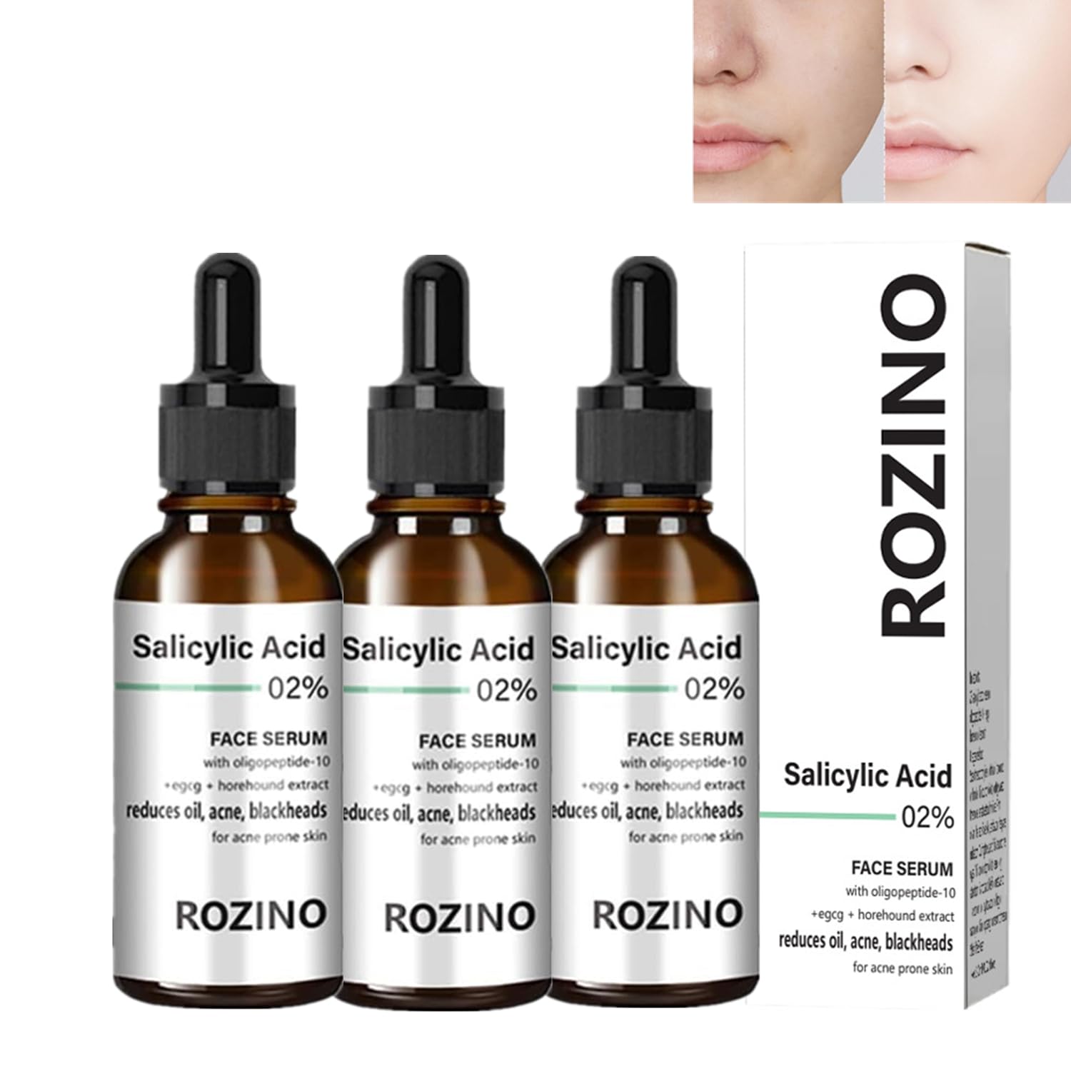 YG LianKai 3PC Face Serum, Rozino Stock Solution Facial Serum